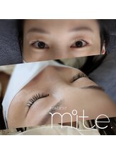 ミテ(mite.)/