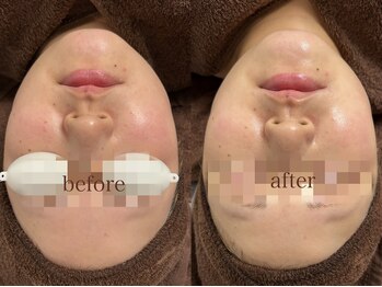 サロン エム(saron M)/お客様ビフォーアフター