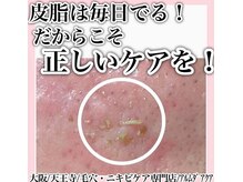 アルムダアクア 天王寺店(Aleumda AQUA)/毛穴エクストラクションプロ