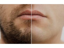 イーネ(ENE)の雰囲気（ヒゲ脱毛モニター募集は今だけ！一回1,625円！）