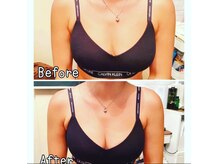 シュシュ(chouchou)/一回で「違う！」を実感！