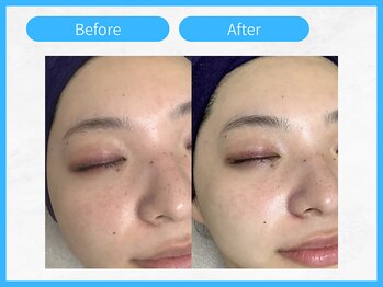 トウメイコガオ 横浜店/