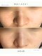 エイル(EILE)の写真/鏡を見るたび、鼻のポツポツを隠していませんか？韓国の「トロイアルケ」で、毛穴汚れも悩みもリセット！