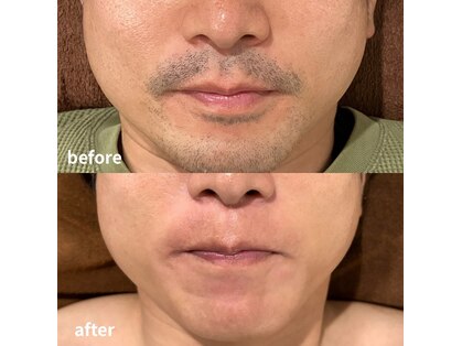 リコー(RICCO)の写真