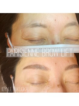 イディール(IDYLLE)/ブロウリフト