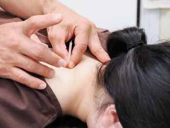 よしゆき鍼灸院の写真/何をしても良くならないと諦めていませんか？首肩コリに特化した一流鍼灸院のオーダーメイド施術で改善！