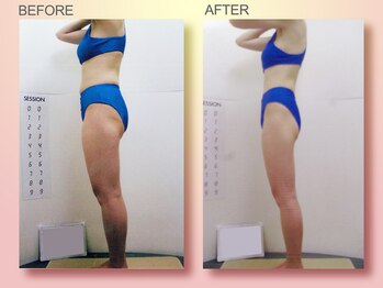 ジュリア オージェ 京橋店/ビフォーアフター(脂肪燃焼)