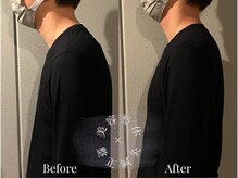 ボー(BeAu)/美容整体×鍼灸　Before After