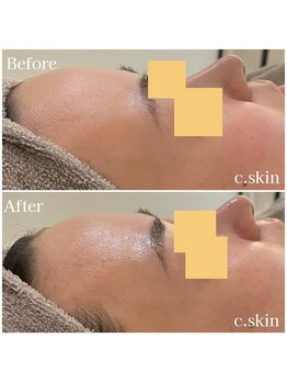シースキン 盛岡駅前店(c.skin)/お客様ビフォーアフター♪