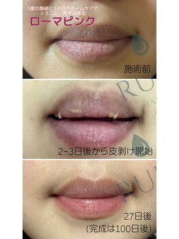 ルポザメンテナンス 長岡店(RUPO THE MAINTENANCE)/