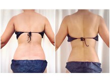 トレゾール(tresor)/★痩身★赤坂痩身エステ