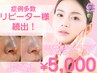人気No.1【韓国式★白玉水光肌かぼちゃピーリング+韓国アンプル導入】