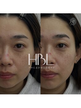 ロジ(loji)/ハリウッドブロウリフト