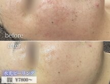 ミレット(Miretto)