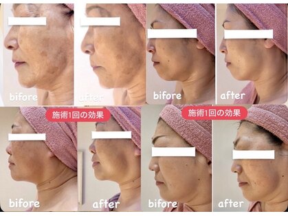 ビジュー(bijou)の写真