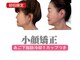 ラシーク(LASEEQ)の写真/あご下脂肪冷却で理想のフェイスラインへ！小顔矯正も◎