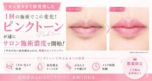 ベリッシマ(Bellissima)