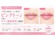 ベリッシマ(Bellissima)の写真
