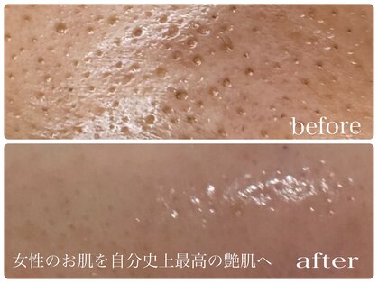 シロ(siro)の写真