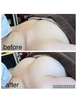 ベルダ(Beldad)/お胸ふっくら ボンボンバスト