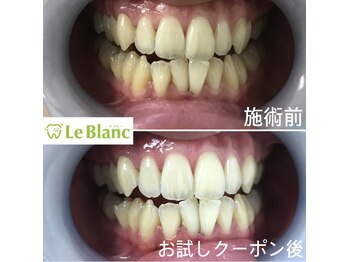 ルブラン 奈良店(Le Blanc)/初めての方