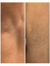 アヴィジョン(Avision)/