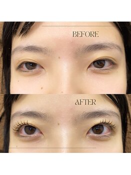 アモール 丸亀店(Amor)/眉毛/まつげパーマ/毛穴/脱毛