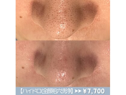 メンズエムボーテ 太田店(Men's M BEAUTE33)の写真