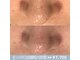 メンズエムボーテ 太田店(Men's M BEAUTE33)の写真