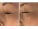 リュウ鍼灸院 サロン ド リュウ(Salon de Ryu)の写真