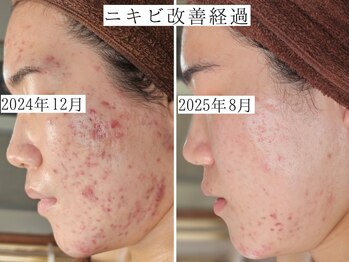 ユウビジン(YOU美人)/