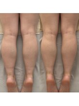 ケリービューティーサロン(kelly beauty salon)/大人気の足リンパ