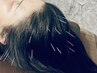 【短時間でスッキリ】育毛促進鍼