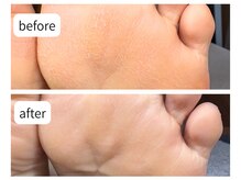 カシェット(Cachette)/30代女性◎足裏角質ケア90分