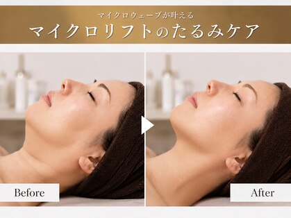 シルキーエービューティー(Silky A Beauty)の写真