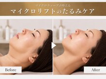 シルキーエービューティー(Silky A Beauty)