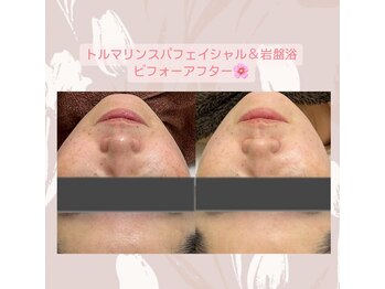 サロンド ユニバース(salon de universe)/トルマリンスパフェイシャル