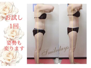 スマイルデイズ(Smiledays)/お試し1回でこの結果♪