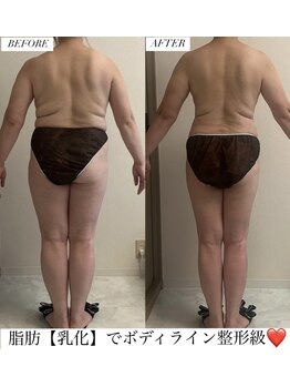 フェミニー(Feminy)/ボディライン激変♪
