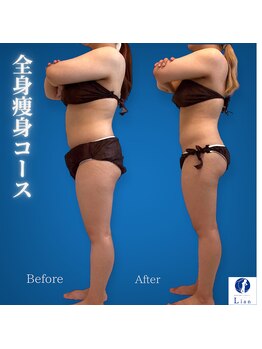 リアン(Lian)/【綺麗に体重を落としたい方】