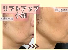 モワメーム(Moi-meme)/