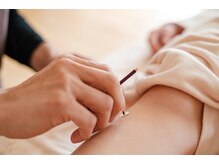 まごころ骨盤整体院 なかもず店/自律神経と経絡を整える鍼灸