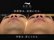 エースビューティーサロン 蒲郡店(ACE. beauty salon)