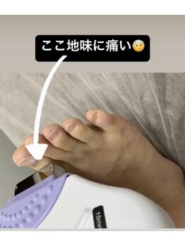 美容脱毛専門サロン エピラージュ 新宿店(Epilage)/指先など細かいパーツもOK