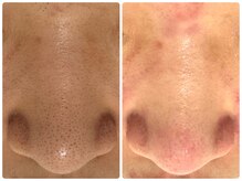 サイセイ(SAISEI)/たった1回の結果です！