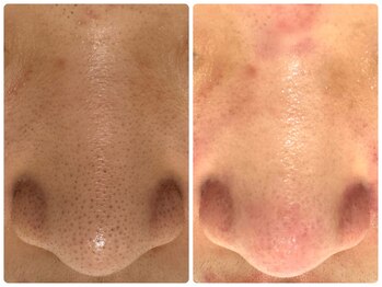 サイセイ(SAISEI)/たった1回の結果です!