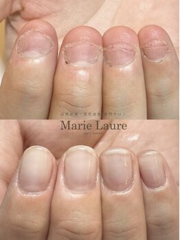 マリーロール 天王寺店(Marie Laure)/自爪育成/深爪矯正/ネイルケア