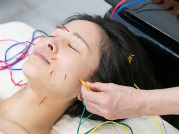 マグノリア/小顔1番人気美容鍼コース