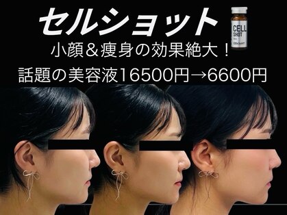 アバナ(ABANA)の写真