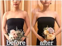 癒楽/デコルテ&巻き肩改善で直角肩へ